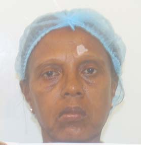patient Image